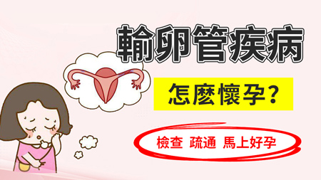 深圳市治療輸卵管堵塞哪家醫院專業